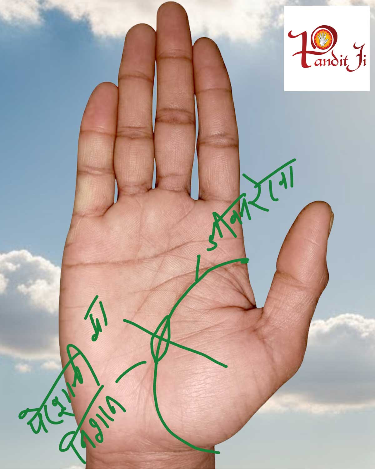 जीवन रेखा पर बीमारी के निशान।