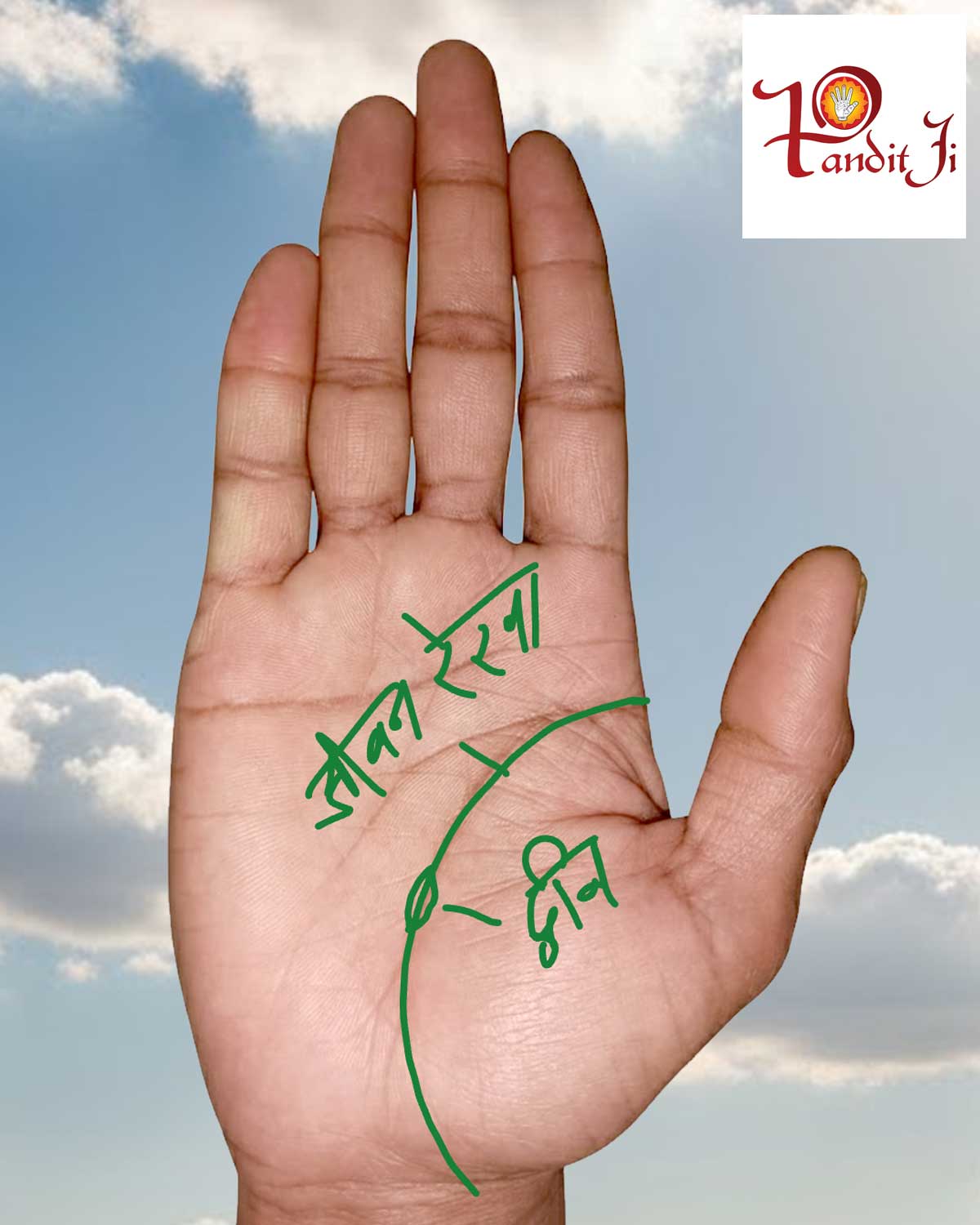 जीवन रेखा पर बीमारी के निशान।